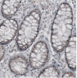 NIFK Antibody (CL2240), Novus Biologicals:Antibodies:Primary Antibodies