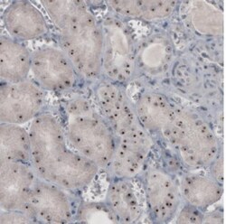 NIFK Antibody (CL2240), Novus Biologicals:Antibodies:Primary Antibodies
