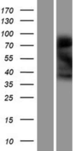 Novus Biologicals&trade;&nbsp;Ninjurin-1 Overexpression Lysate