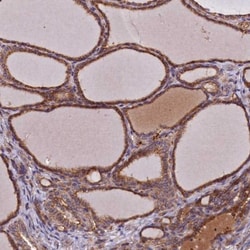 NIP Antibody, Novus Biologicals:Antibodies:Primary Antibodies