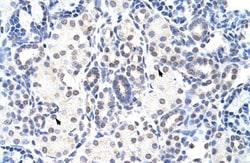 NIP7 Antibody, Novus Biologicals 100&mu;L; Unlabeled:Antibodies, Polyclonal