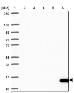 NIP7 Antibody, Novus Biologicals 0.1mL; Unlabeled:Antibodies, Polyclonal