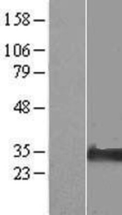 Novus Biologicals&trade;&nbsp;NIPA2 Overexpression Lysate
