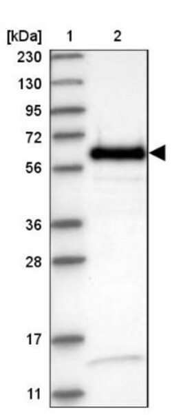 NIPA Antibody, Novus Biologicals 25 &mu;L; Unlabeled:Antibodies, Polyclonal