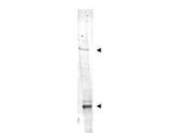 NIPBL Antibody, Novus Biologicals 0.1mg; Unlabeled:Antibodies, Polyclonal