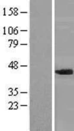 Novus Biologicals&trade;&nbsp;NIPP1 Overexpression Lysate