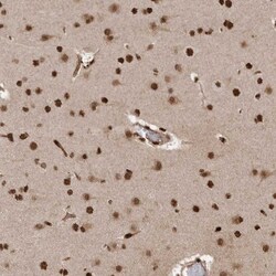 NIPP1 Antibody, Novus Biologicals 0.1mL; Unlabeled:Antibodies, Polyclonal