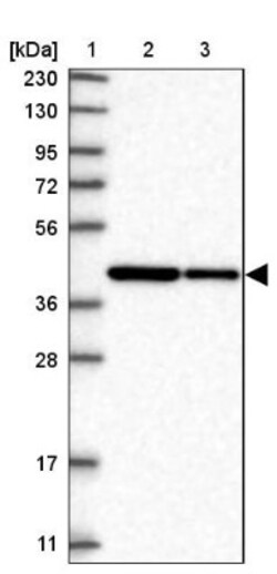 NIPP1 Antibody, Novus Biologicals 0.1mL; Unlabeled:Antibodies, Polyclonal