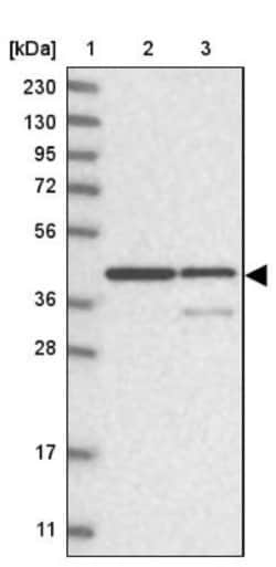 NIPP1 Antibody, Novus Biologicals:Antibodies:Primary Antibodies