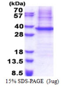 Novus Biologicals&trade;&nbsp;Recombinant Human NIPSNAP1 His Protein