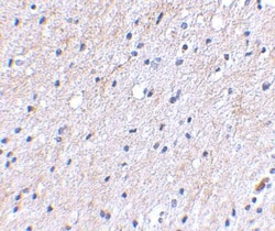 NIPSNAP1 Antibody - BSA Free, Novus Biologicals 0.1mg; Unlabeled:Antibodies,