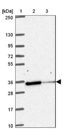 NIPSNAP1 Antibody, Novus Biologicals 0.1mL; Unlabeled:Antibodies, Polyclonal