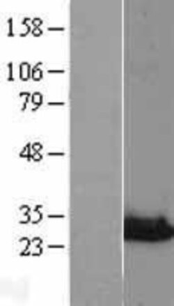 Novus Biologicals&trade;&nbsp;NIPSNAP3A Overexpression Lysate