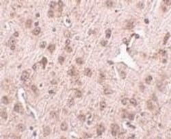 NIPSNAP3A Antibody - BSA Free, Novus Biologicals 0.1mg; Unlabeled:Antibodies,