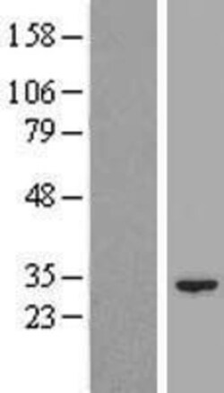 Novus Biologicals&trade;&nbsp;NIPSNAP3B Overexpression Lysate
