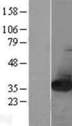 Novus Biologicals&trade;&nbsp;NIT2 Overexpression Lysate