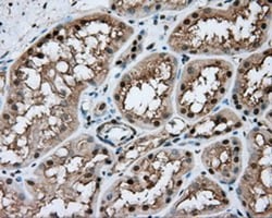 Nitrilase 1 Antibody (OTI3A11), Novus Biologicals 0.1mL; Unlabeled:Antibodies,