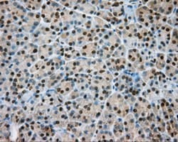 Nitrilase 1 Antibody (OTI3A11), Novus Biologicals 0.1mL; Unlabeled:Antibodies,