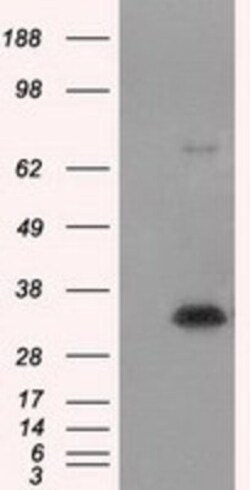 Nitrilase 1 Antibody (OTI3A11), Novus Biologicals 0.1mL; Unlabeled:Antibodies,