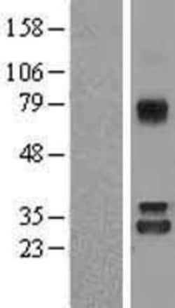 Novus Biologicals&trade;&nbsp;Nitrilase 1 Overexpression Lysate