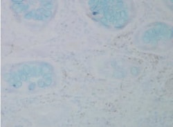 Nitrotyrosine Antibody (39B6), Novus Biologicals 0.1mg; Unlabeled:Antibodies,