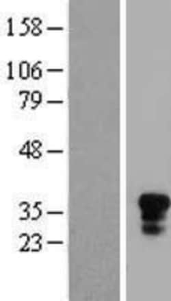 Novus Biologicals&trade;&nbsp;CD161 Overexpression Lysate