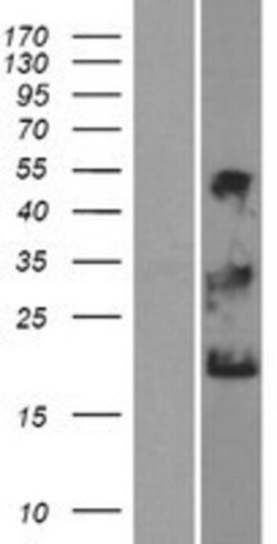 Novus Biologicals™ NKAIN1 Overexpression Lysate