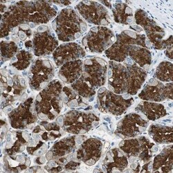 NKAIN1 Antibody, Novus Biologicals 0.1mL; Unlabeled:Antibodies, Polyclonal