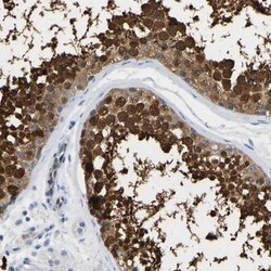 NKAIN3 Antibody, Novus Biologicals 25 &mu;L, Unlabeled:Antibodies, Polyclonal