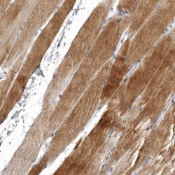 NKAIN4 Antibody, Novus Biologicals 0.1mL; Unlabeled:Antibodies, Polyclonal