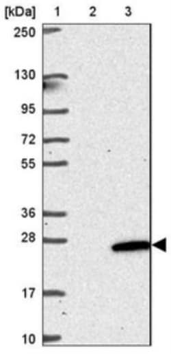 NKAIN4 Antibody, Novus Biologicals 0.1mL; Unlabeled:Antibodies, Polyclonal