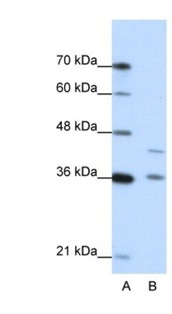 NKD2 Antibody, Novus Biologicals:Antibodies:Primary Antibodies
