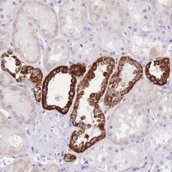 NKD2 Antibody, Novus Biologicals:Antibodies:Primary Antibodies
