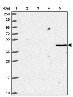 NKD2 Antibody, Novus Biologicals:Antibodies:Primary Antibodies