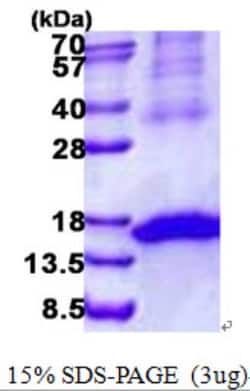 Novus Biologicals Recombinant Human NKG2D/CD314 His Protein 0,1 mg | Buy Online | Novus Biologicals&trade; | Fisher Scientific