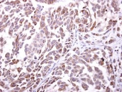 NKG2D/CD314 Antibody, Novus Biologicals 0.1mL:Antibodies, Polyclonal