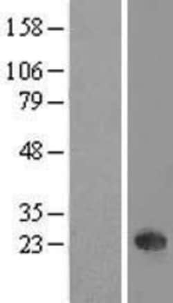 Novus Biologicals&trade;&nbsp;NKIRAS1 Overexpression Lysate