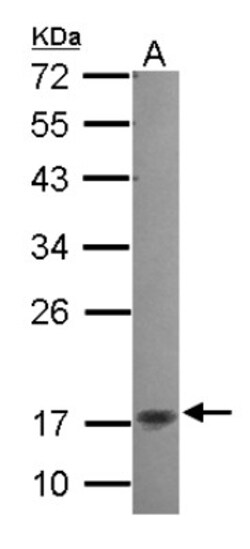 NKIRAS2 Antibody, Novus Biologicals 0.1mL; Unlabeled:Antibodies, Polyclonal