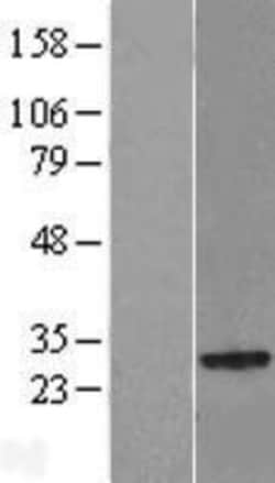Novus Biologicals&trade;&nbsp;NKIRAS2 Overexpression Lysate