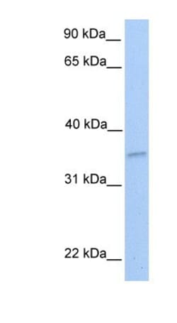 NKIRAS2 Antibody, Novus Biologicals 100&mu;L; Unlabeled:Antibodies, Polyclonal