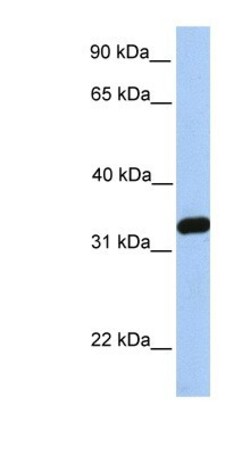 NKIRAS2 Antibody, Novus Biologicals:Antibodies:Primary Antibodies
