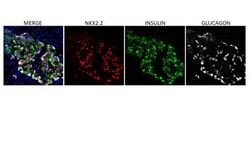 NKX2.2 Antibody (NX2/294), Novus Biologicals:Anticuerpos:Anticuerpos primarios