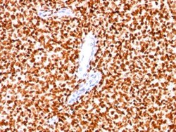 NKX2.2 Antibody (NX2/294), Novus Biologicals:Anticuerpos:Anticuerpos primarios