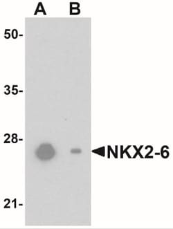 NKX2.6 Antibody - BSA Free, Novus Biologicals 0.1mg; Unlabeled:Antibodies,