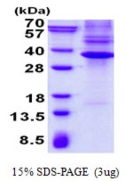 Novus Biologicals&trade;&nbsp;Recombinant Human NKX3.1 His Protein