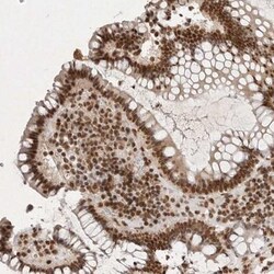 NKX3-2 Antibody, Novus Biologicals 25 &mu;L; Unlabeled:Antibodies, Polyclonal