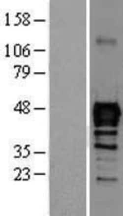 Novus Biologicals&trade;&nbsp;NKX6.1 Overexpression Lysate