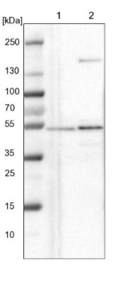 NLE1 Antibody, Novus Biologicals 0.1mL; Unlabeled:Antibodies, Polyclonal