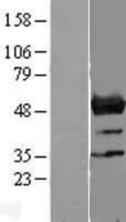 Novus Biologicals&trade;&nbsp;NLE1 Overexpression Lysate