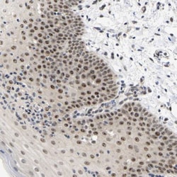 NLE1 Antibody, Novus Biologicals 0.1mL; Unlabeled:Antibodies, Polyclonal